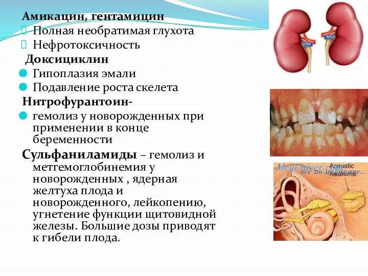 Амикацин, гентамицин Полная необратимая глухота Нефротоксичность Доксициклин Гипоплазия эмали Подавление