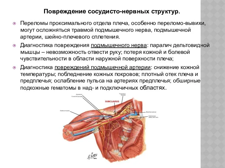 Переломы проксимального отдела плеча, особенно переломо-вывихи, могут осложняться травмой подмышечного