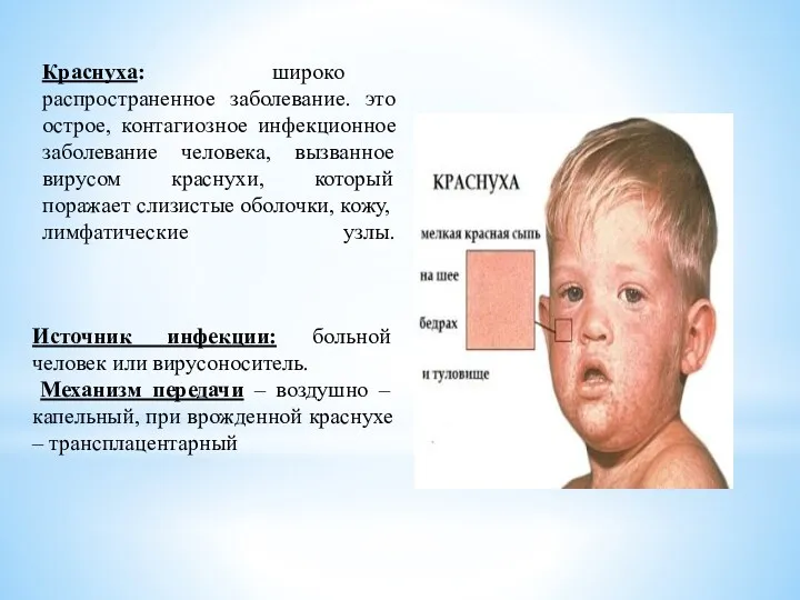 Краснуха: широко распространенное заболевание. это острое, контагиозное инфекционное заболевание человека, вызванное вирусом краснухи,