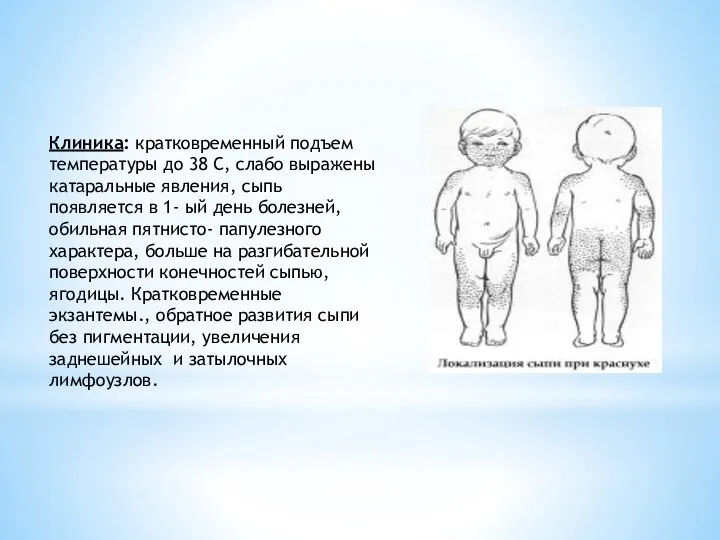 Клиника: кратковременный подъем температуры до 38 С, слабо выражены катаральные явления, сыпь появляется