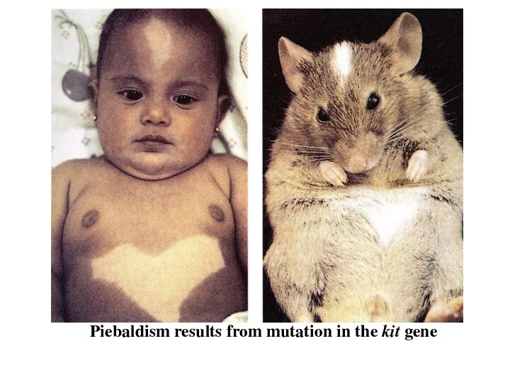 Piebaldism results from mutation in the kit gene