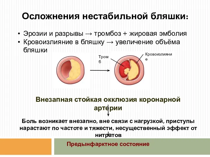 Осложнения нестабильной бляшки: Эрозии и разрывы → тромбоз + жировая эмболия Кровоизлияние в