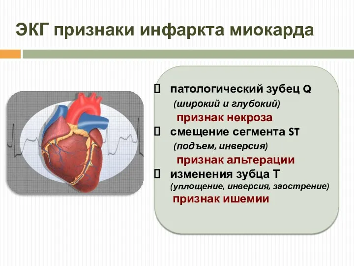 ЭКГ признаки инфаркта миокарда патологический зубец Q (широкий и глубокий) признак некроза смещение