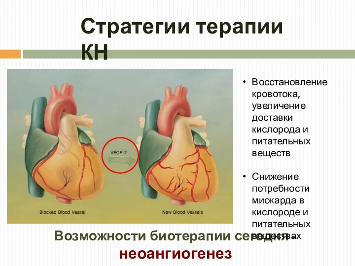 Возможности биотерапии сегодня - неоангиогенез Стратегии терапии КН Восстановление кровотока, увеличение доставки кислорода