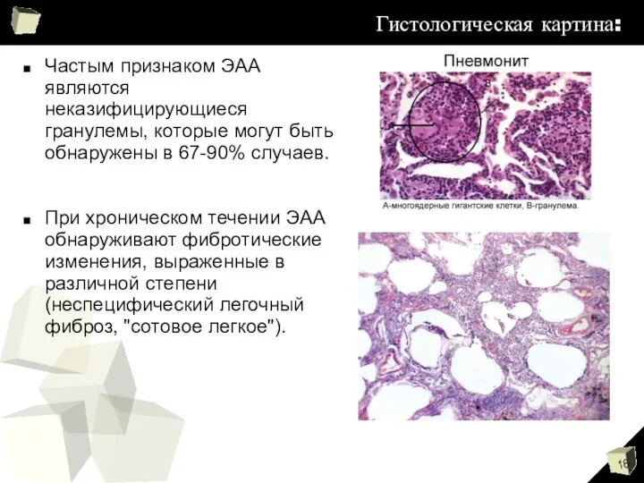 Гистологическая картина: Частым признаком ЭАА являются неказифицирующиеся гранулемы, которые могут