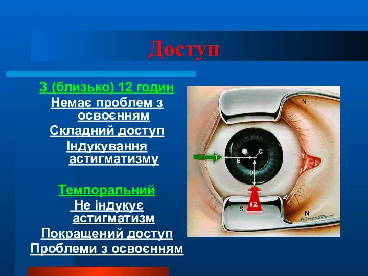 Доступ З (близько) 12 годин Немає проблем з освоєнням Складний