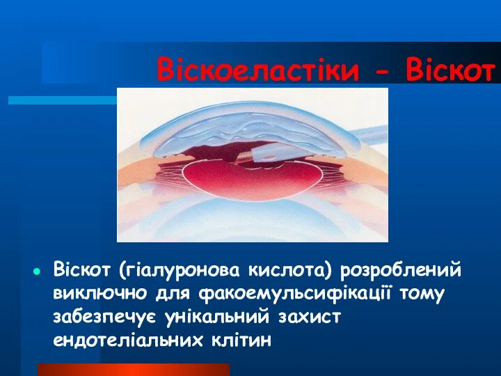 Віскоеластіки - Віскот Віскот (гіалуронова кислота) розроблений виключно для факоемульсифікації тому забезпечує унікальний захист ендотеліальних клітин