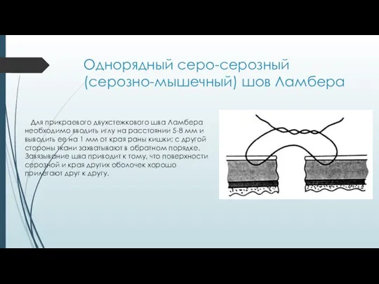 Однорядный серо-серозный (серозно-мышечный) шов Ламбера Для прикраевого двухстежкового шва Ламбера