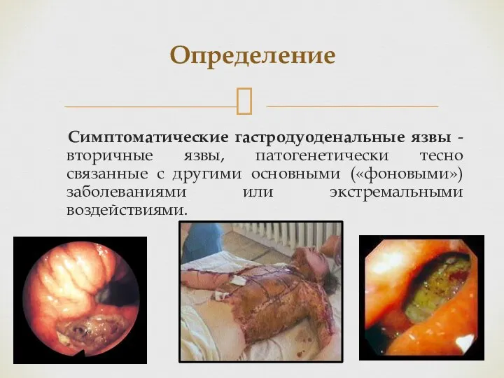 Определение Симптоматические гастродуоденальные язвы - вторичные язвы, патогенетически тесно связанные с другими основными