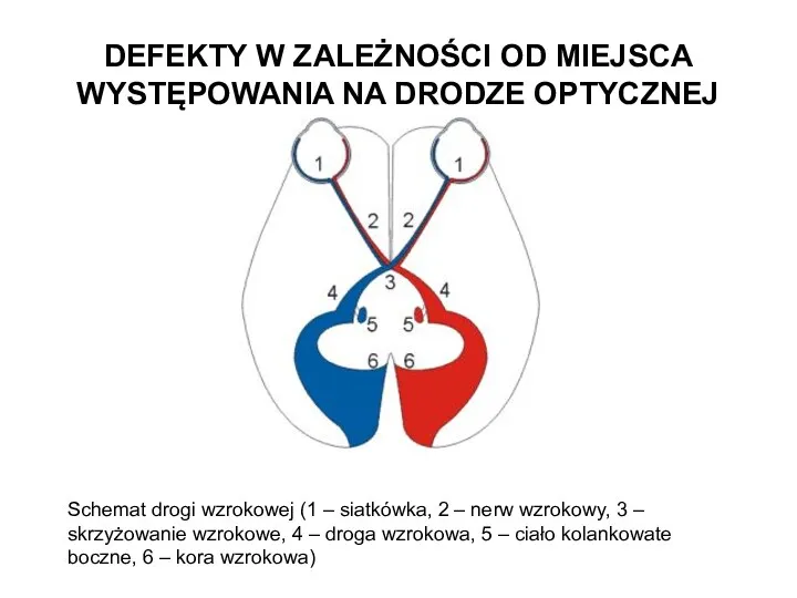 DEFEKTY W ZALEŻNOŚCI OD MIEJSCA WYSTĘPOWANIA NA DRODZE OPTYCZNEJ Schemat