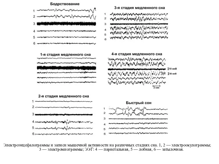 Электроэнцефалограммы и записи мышечной активности на различных стадиях сна. 1,