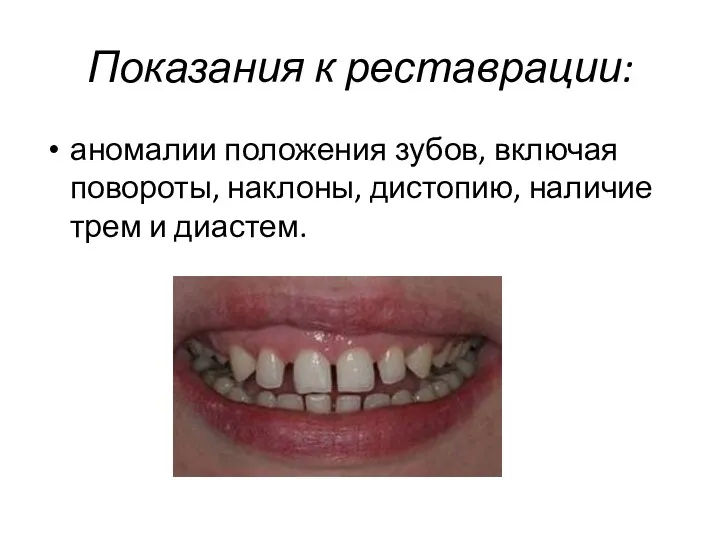 Показания к реставрации: аномалии положения зубов, включая повороты, наклоны, дистопию, наличие трем и диастем.