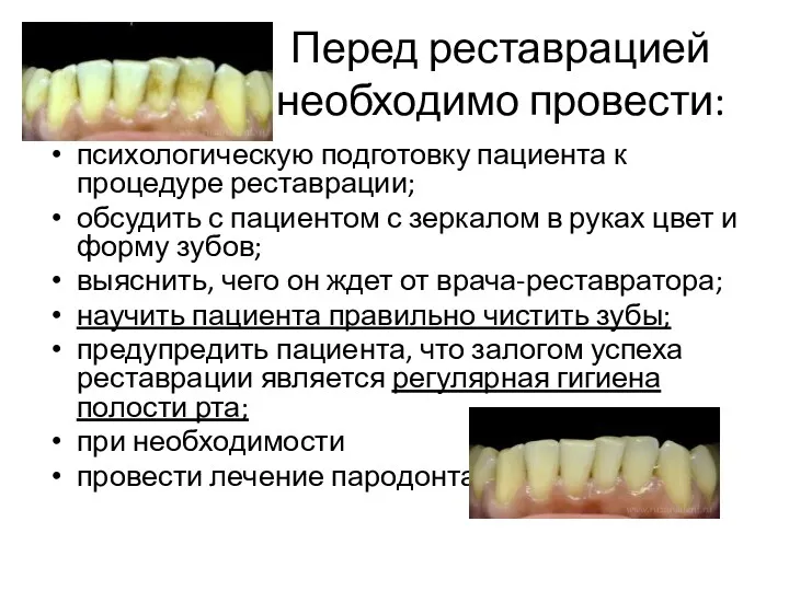 Перед реставрацией необходимо провести: психологическую подготовку пациента к процедуре реставрации;