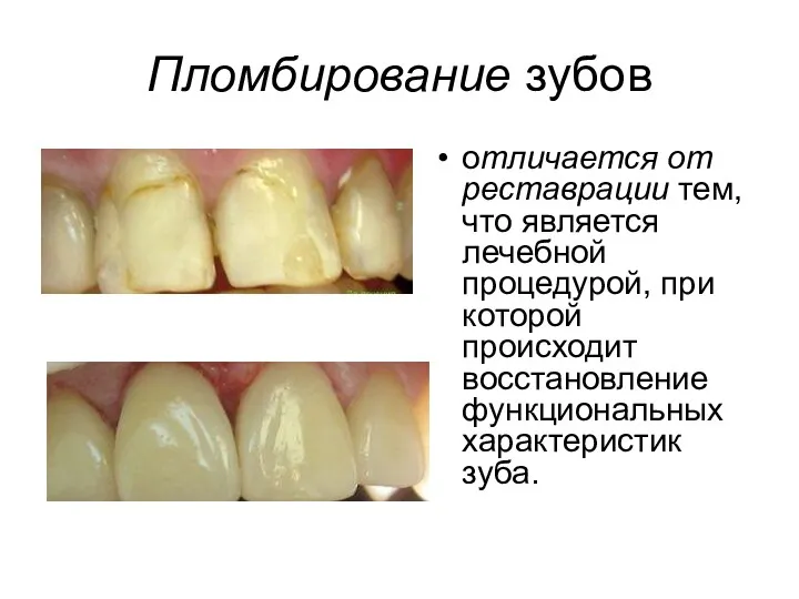 . . Пломбирование зубов отличается от реставрации тем, что является лечебной процедурой, при