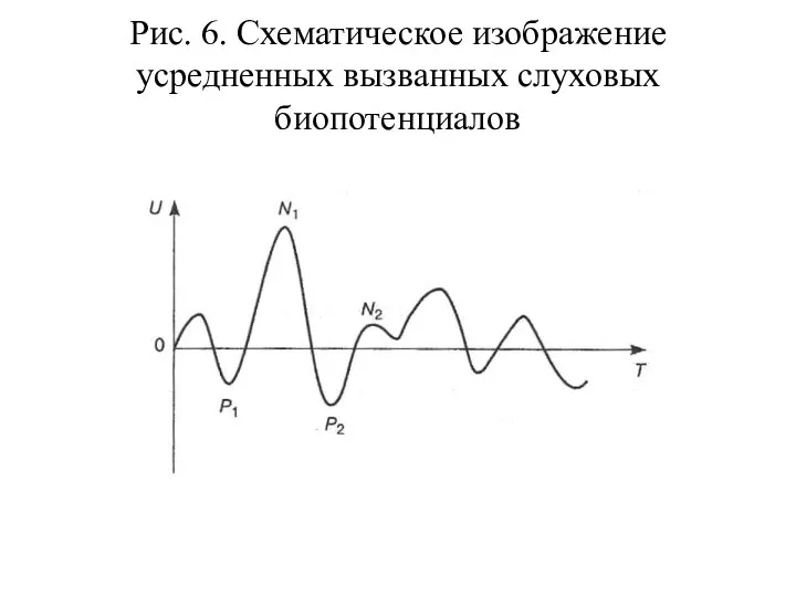 Рис. 6. Схематическое изображение усредненных вызванных слуховых биопотенциалов