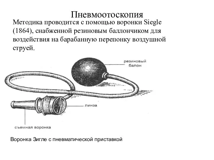 Пневмоотоскопия Методика проводится с помощью воронки Siegle (1864), снабженной резиновым