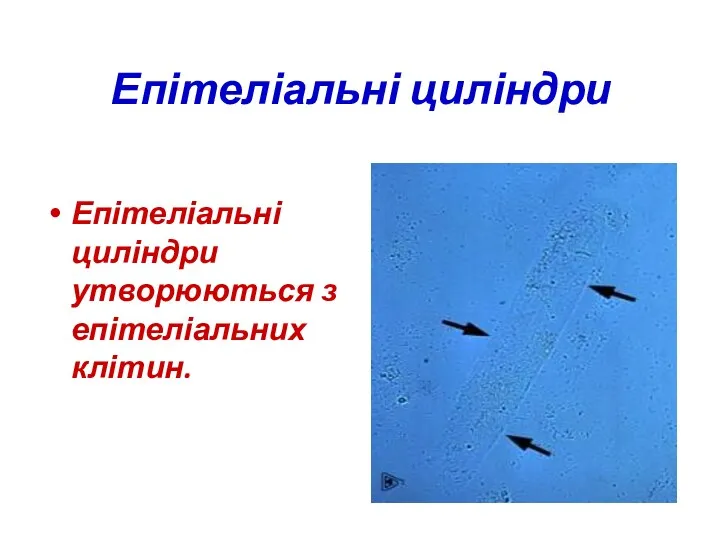 Епітеліальні циліндри Епітеліальні циліндри утворюються з епітеліальних клітин.