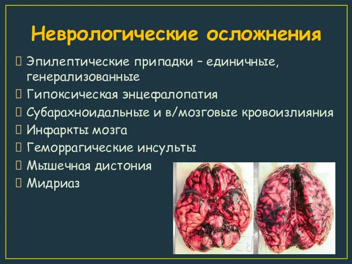 Неврологические осложнения Эпилептические припадки – единичные, генерализованные Гипоксическая энцефалопатия Субарахноидальные