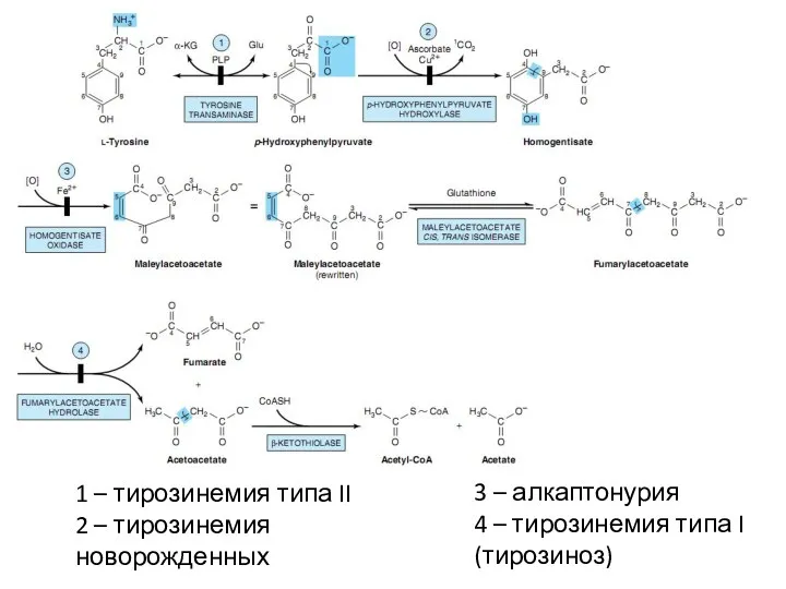 1 – тирозинемия типа II 2 – тирозинемия новорожденных 3