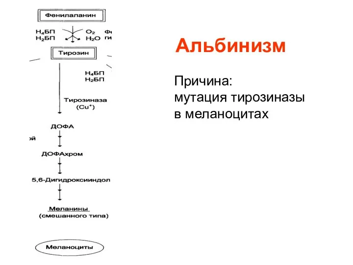 Альбинизм Причина: мутация тирозиназы в меланоцитах