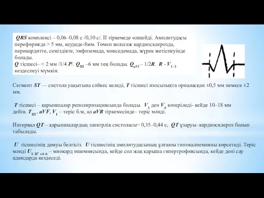 Сегмент ST — систола уақытына сәйкес келеді, Т тісшесі изосызықта