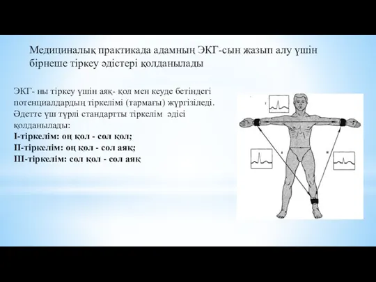 ЭКГ- ны тіркеу үшін аяқ- қол мен кеуде бетіндегі потенциалдардың