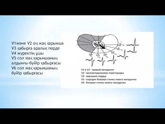 V1және V2 оң жақ қарынша V3 қабырға аралық перде V4