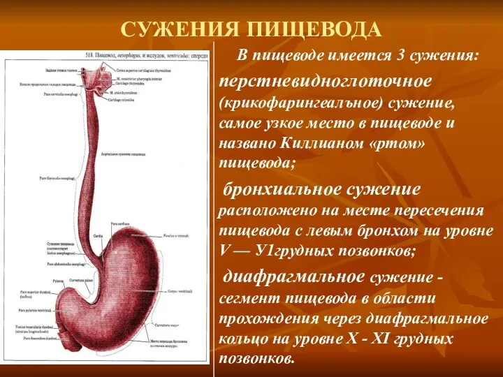 СУЖЕНИЯ ПИЩЕВОДА