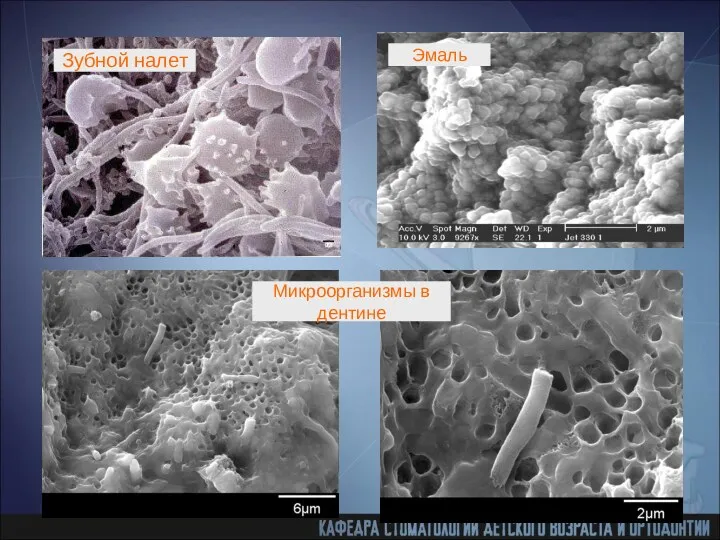 Эмаль Зубной налет Микроорганизмы в дентине