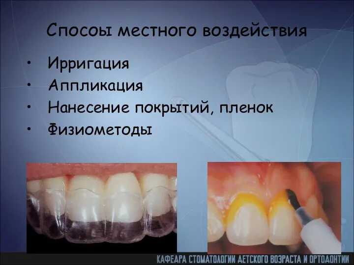 Спосоы местного воздействия Ирригация Аппликация Нанесение покрытий, пленок Физиометоды