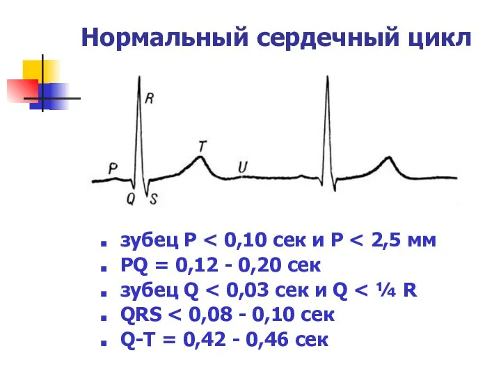 Нормальный сердечный цикл зубец P PQ = 0,12 - 0,20