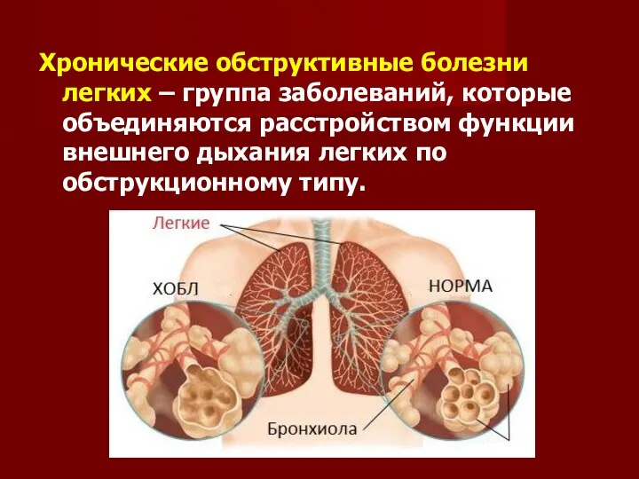 Хронические обструктивные болезни легких – группа заболеваний, которые объединяются расстройством