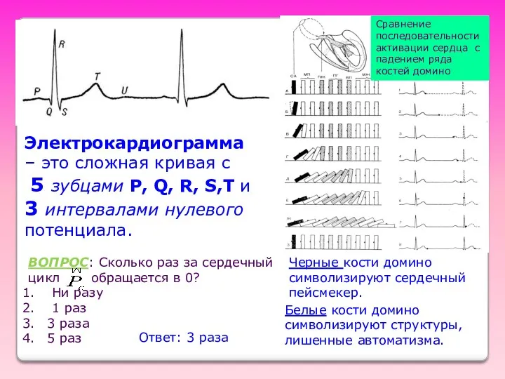 Электрокардиограмма – это сложная кривая с 5 зубцами P, Q, R, S,T и