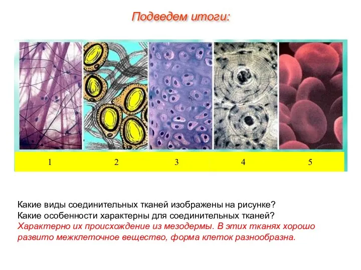 Какие виды соединительных тканей изображены на рисунке? Какие особенности характерны для соединительных тканей?