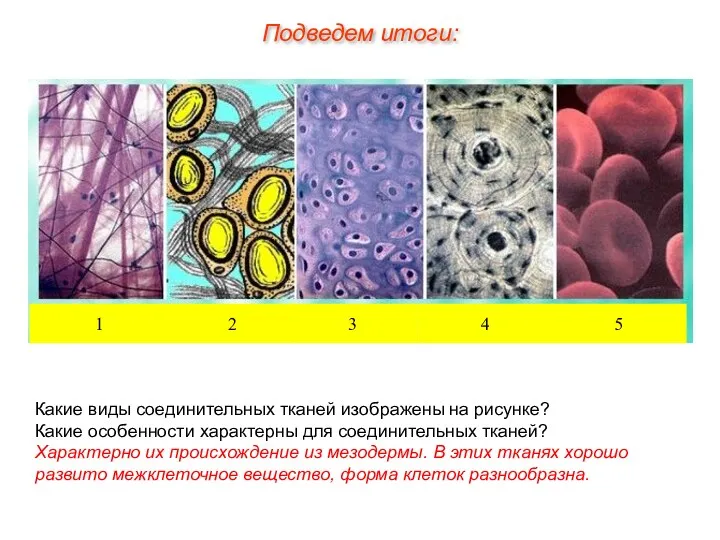 Какие виды соединительных тканей изображены на рисунке? Какие особенности характерны