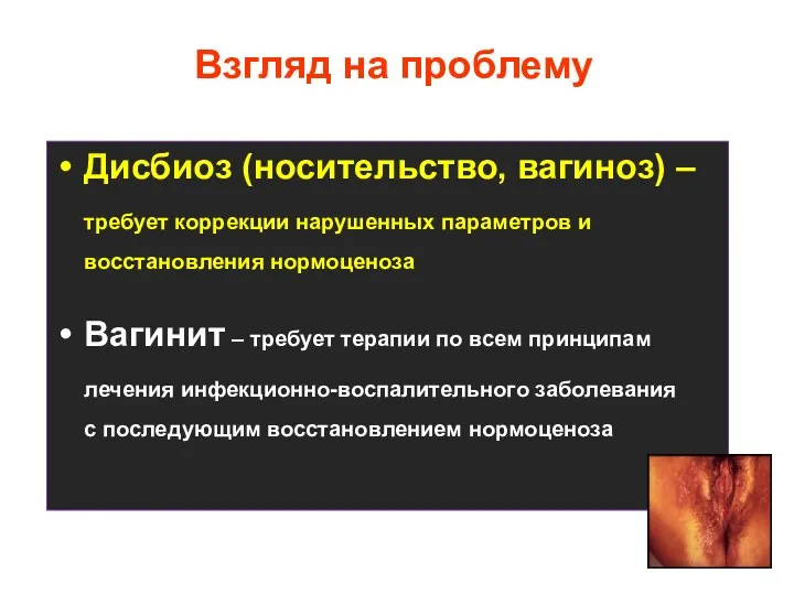 Взгляд на проблему Дисбиоз (носительство, вагиноз) – требует коррекции нарушенных