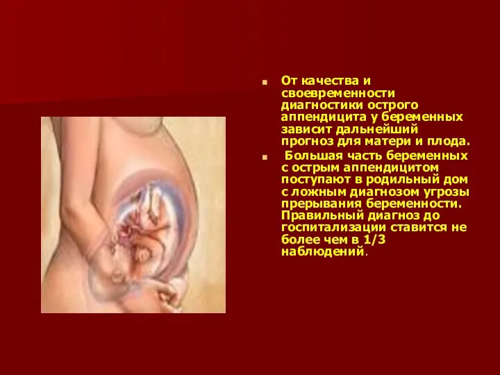 От качества и своевременности диагностики острого аппендицита у беремен­ных зависит