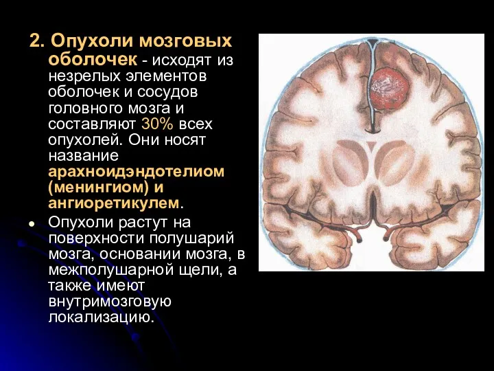 2. Опухоли мозговых оболочек - исходят из незрелых элементов оболочек