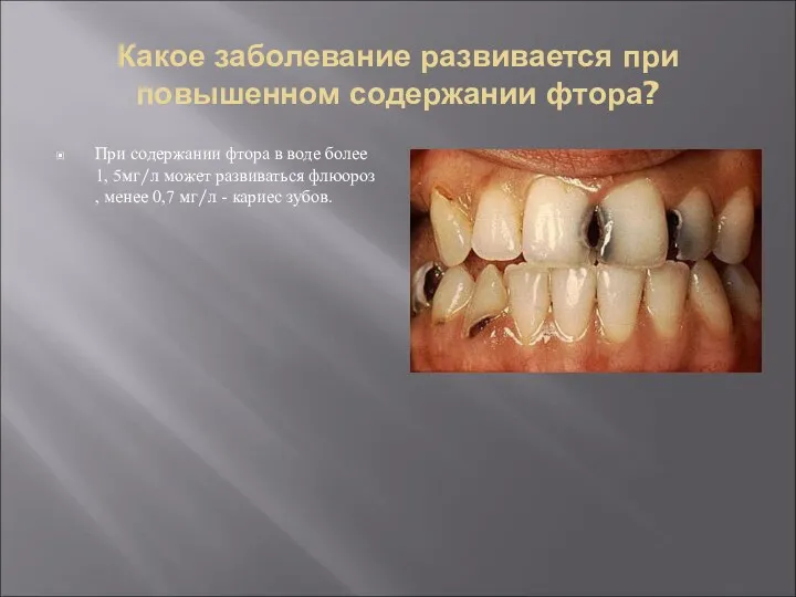 Какое заболевание развивается при повышенном содержании фтора? При содержании фтора