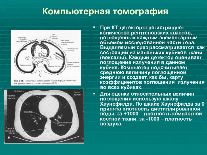 Компьютерная томография При КТ детекторы регистрируют количество рентгеновских квантов, поглощенных