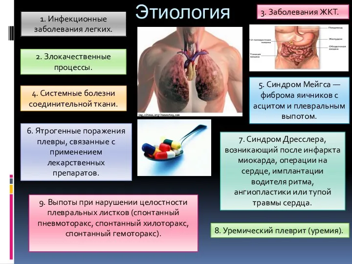 Этиология 1. Инфекционные заболевания легких. 2. Злокачественные процессы. 3. Заболевания