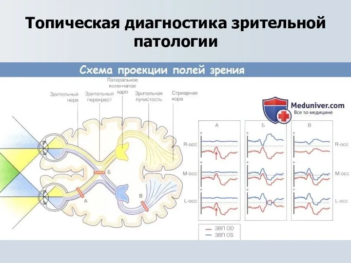 Топическая диагностика зрительной патологии