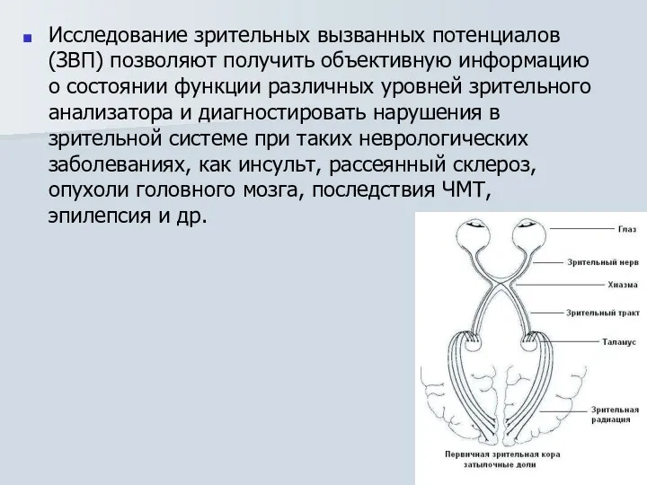 Исследование зрительных вызванных потенциалов (ЗВП) позволяют получить объективную информацию о