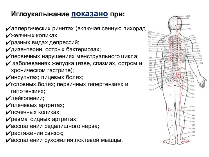 Иглоукалывание показано при: аллергических ринитах (включая сенную лихорадку); желчных коликах; разных видах депрессий;