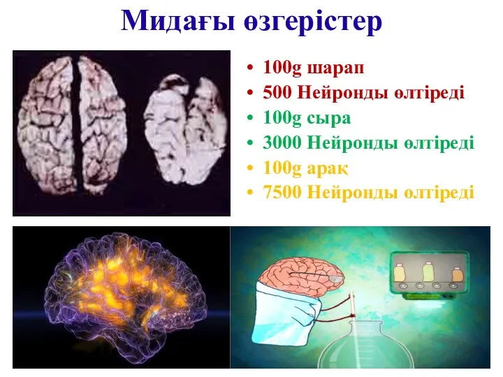 Мидағы өзгерістер 100g шарап 500 Нейронды өлтіреді 100g сыра 3000