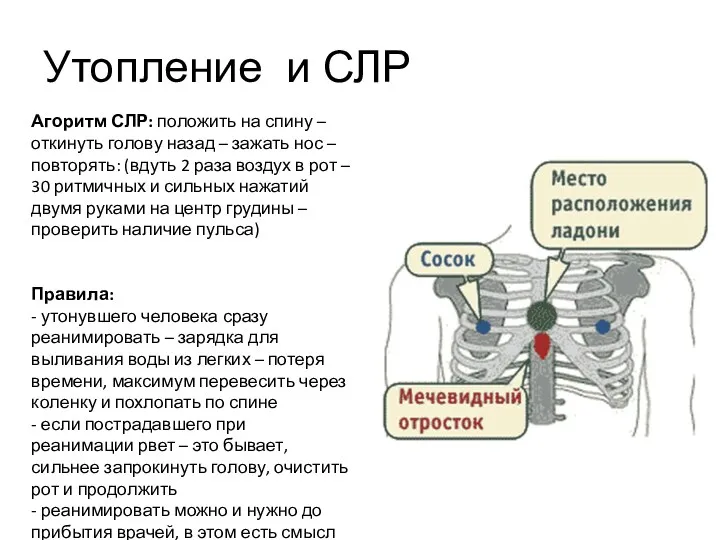 Утопление и СЛР Агоритм СЛР: положить на спину – откинуть