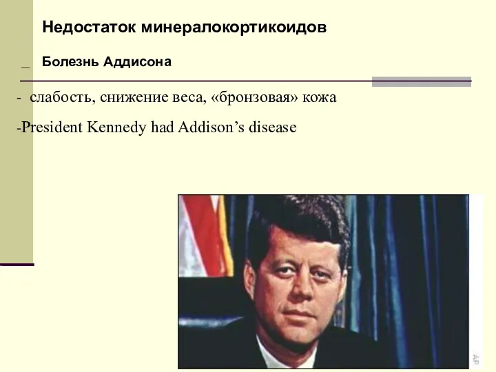 – слабость, снижение веса, «бронзовая» кожа President Kennedy had Addison’s disease Недостаток минералокортикоидов Болезнь Аддисона