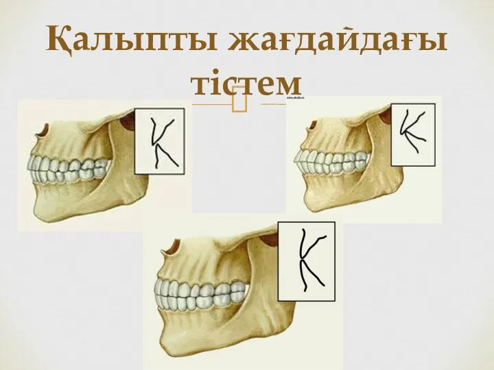 Қалыпты жағдайдағы тістем