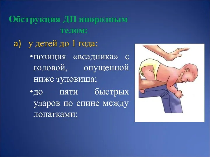 Обструкция ДП инородным телом: у детей до 1 года: позиция