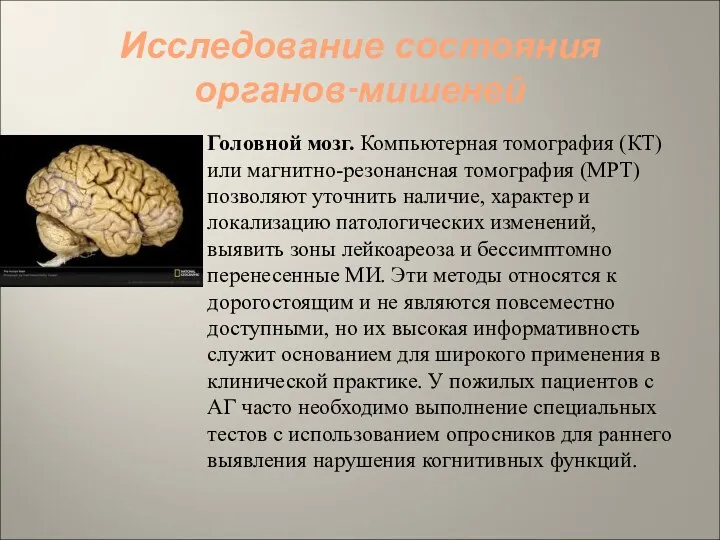 Исследование состояния органов-мишеней Головной мозг. Компьютерная томография (КТ) или магнитно-резонансная томография (МРТ) позволяют